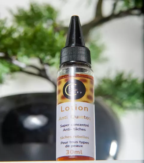 Lotion anti quintos